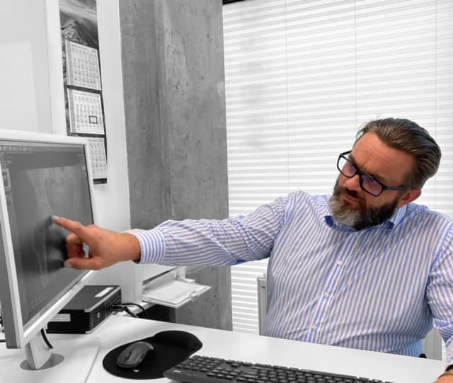 Czy zastrzyk z kwasu hialuronowego w biodro boli? Oczekiwany ból i dyskomfort Czy zastrzyk z kwasu hialuronowego w biodro boli? Oczekiwany ból i dyskomfort