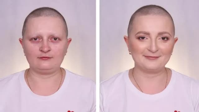 Czy po chemii wypadają brwi i rzęsy? Poznaj prawdę o skutkach terapii Czy po chemii wypadają brwi i rzęsy? Poznaj prawdę o skutkach terapii