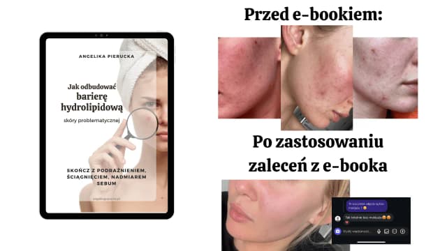 Skuteczne sposoby na czerwone plamy po pryszczach i ich redukcję Skuteczne sposoby na czerwone plamy po pryszczach i ich redukcję